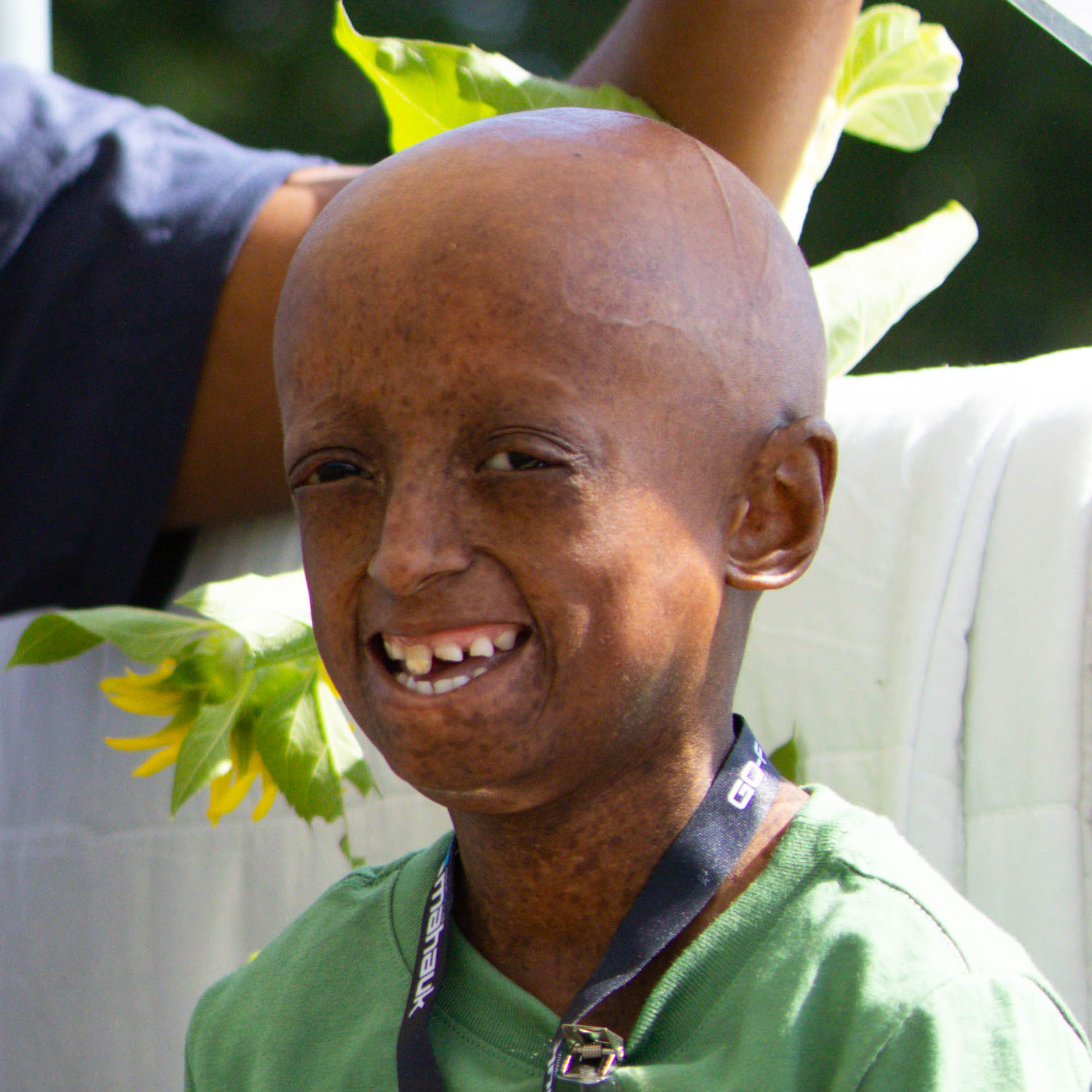 A smiling child with a bald head wearing a green shirt and a lanyard, sitting outdoors. Bright sunlight and greenery are visible in the background.